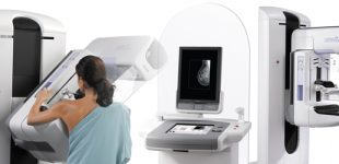 1-SKRINING-MAMOGRAFIYA